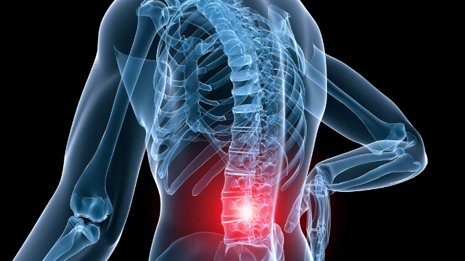 Gejala low back painyang harus anda ketahui. Simak penjelasannya