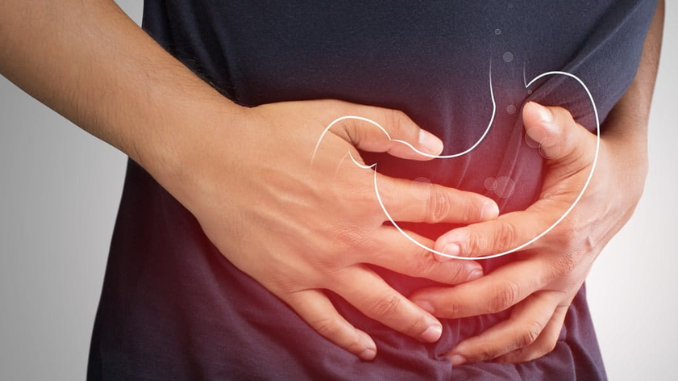 Memahami perbedaan sakit maag dan GERD sangat penting untuk menentukan langkah penanganan yang paling sesuai.